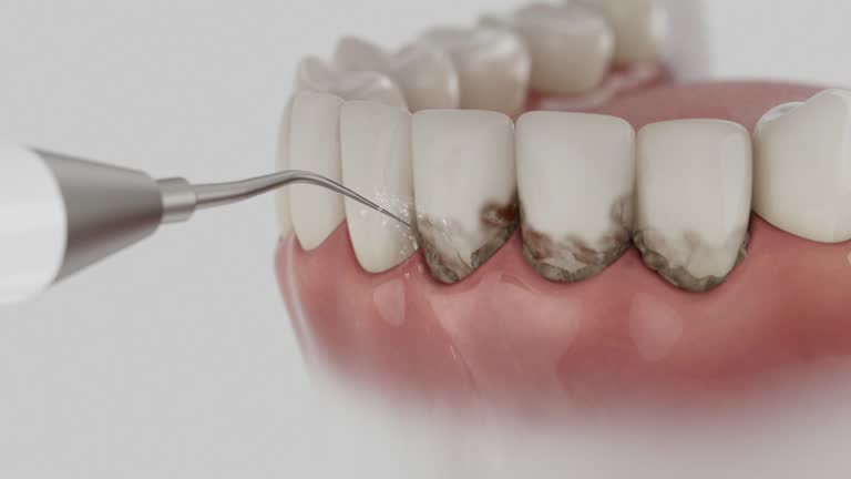 Trusted Root Canal Treatment service in Salem, IN - Dentist Open Now